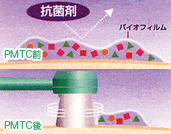 虫歯予防　PMTC